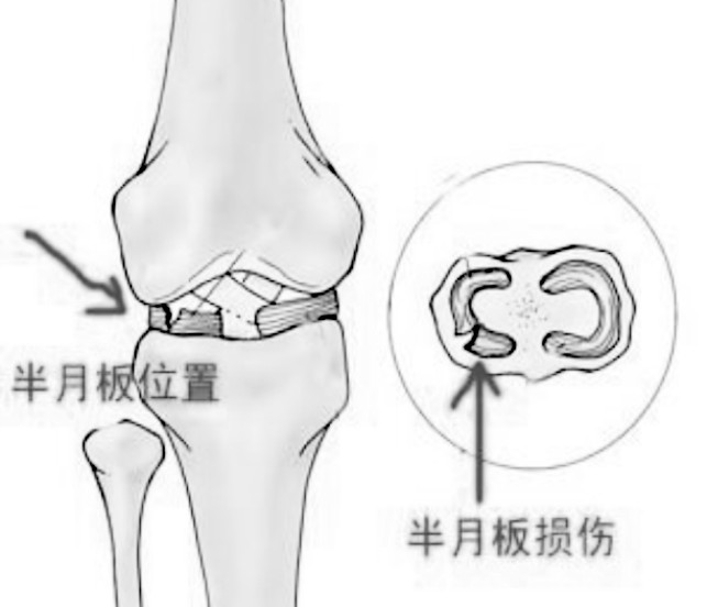 山东中医xx膝关节扭伤选广盛源医药