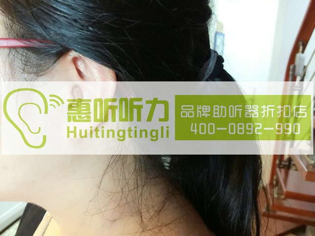 上海青浦奥迪康笑语助听器