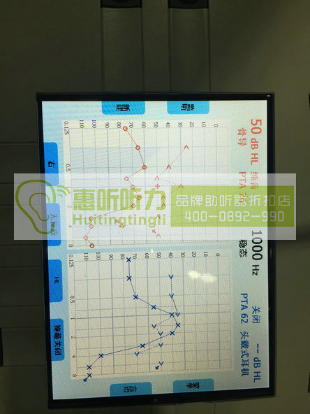上海黄浦助听器全场298元起