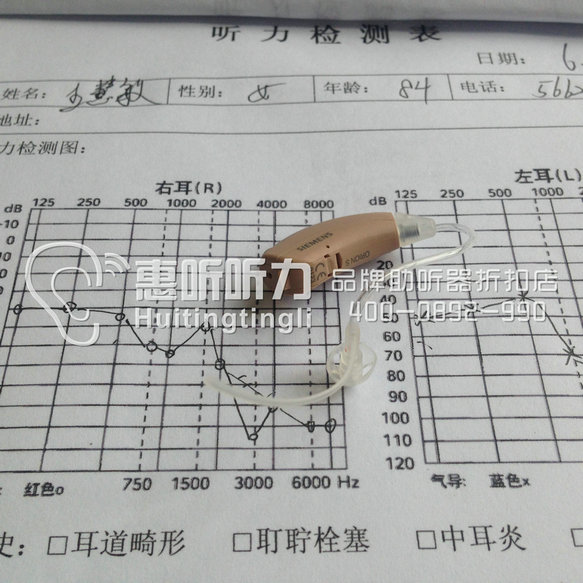 上海浦东助听器哪里最专业