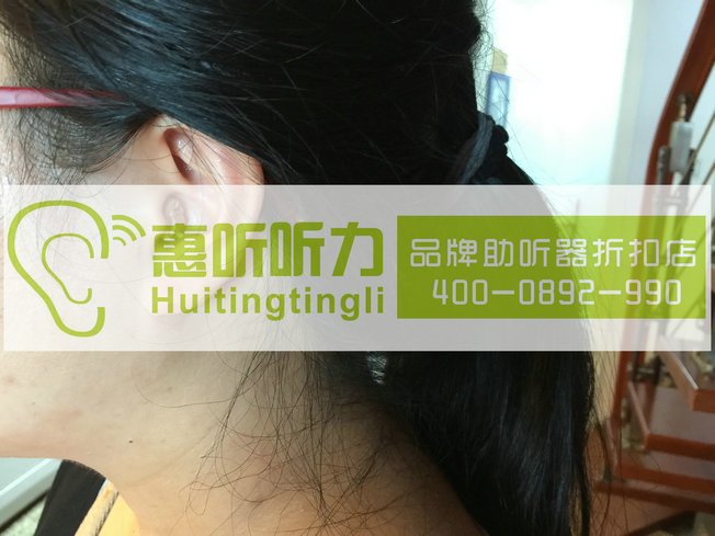 上海浦东奥迪康隐形助听器价格