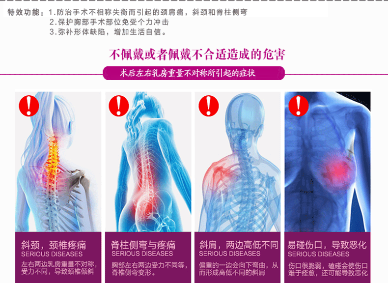 2015深圳龍崗蒂億曼術后加長加厚義乳原始圖片3