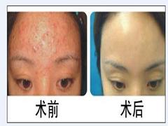 {yl}的西安bhzl推薦，西安bhzl大夫
