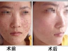 西安德通醫(yī)院皮膚科_專業(yè)西安銀屑病治療機(jī)構(gòu)，西安銀屑病治療機(jī)構(gòu)