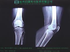 菏澤OT10檢耳鏡_的OT10檢耳鏡價格怎么樣