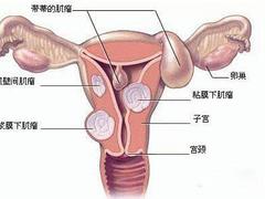 【快快行動！】得了腰腿疼怎么辦,腰腿疼的風險—@青島天道中醫