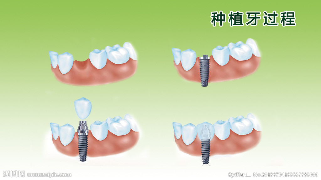 泉州哪家醫(yī)院zl牙齦出血   泉州看恒牙    泉州看