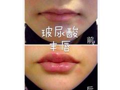 {薦}上海知名的注射美容整形培訓(xùn)，受歡迎的注射美容整形培訓(xùn)