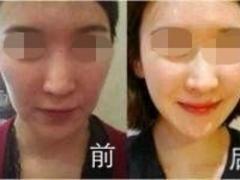虹口美容整形培訓_上海市可信賴的美容整形培訓提供