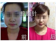 注射美容整形培訓(xùn)公司，創(chuàng)新的注射美容整形培訓(xùn)上哪找