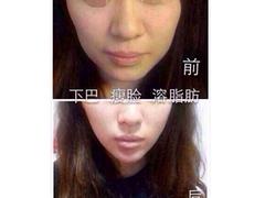 具有品牌的微整形：{lx1}的整形美容培訓基地---妃美