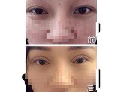 價格合理的注射美容整形培訓，上海知名的注射美容整形培訓資訊