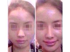 價格合理的注射美容整形培訓，上海知名的注射美容整形培訓資訊