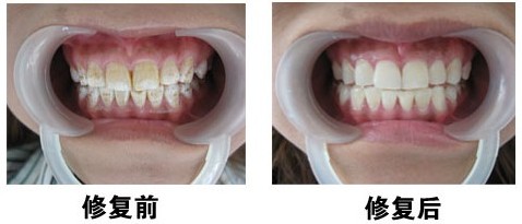 北京通州區(qū)多生牙zl醫(yī)院哪家好