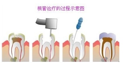 北京通州韓系種植牙費(fèi)用 想要口腔疾病zl就來齒康口腔