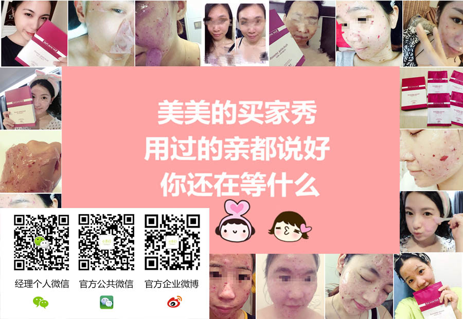 小木C代理優惠政策,小木C代理有效果嗎