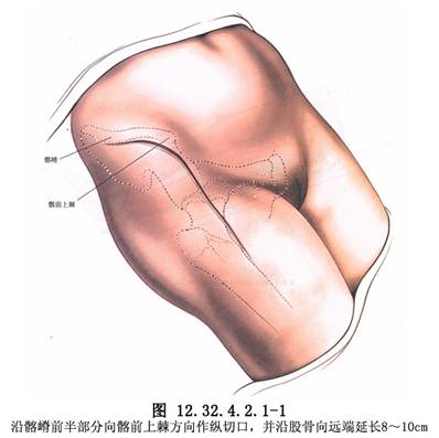 【中医zl】泰安随治随走的膝关节扭伤