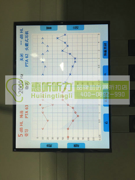 上海市虹口區(qū)西門子助聽器